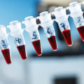 Choosing the Right COVID-19 Test: Understanding the Differences Between PCR and Regular Tests