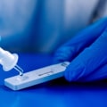 The Importance of PCR Testing and Rapid Tests in the Era of Omicron