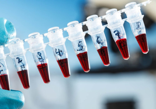 Choosing the Right COVID-19 Test: Understanding the Differences Between PCR and Regular Tests